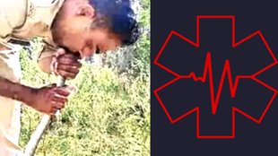 Snake| CPR| police