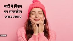 सर्दी में स्किन की देखभाल करना चाहते हैं, इन 10 टिप्स को अपना लें, विंटर में खिली-खिली दिखेगी त्वचा