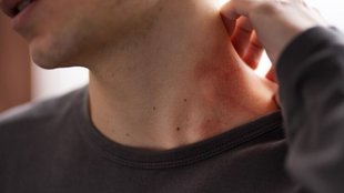 diabetes symptoms,diabetes signs seen on skin,diabetes signs on skin,diabetes signs, diabetes symptoms on the skin