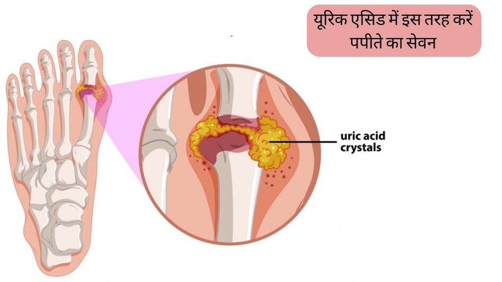 Papaya For Uric Acid । Uric Acid । Uric Acid Treatment