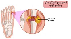 Papaya For Uric Acid: जोड़ों में जमा होने लगे हैं यूरिक एसिड के क्रिस्टल और दर्द से हर वक्त रहते हैं बेहाल? पपीते को इस तरह कर लें डाइट में शामिल, दूर हो जाएगी परेशानी