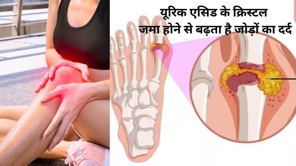 consume foods for uric acid control,यूरिक एसिड कैसे कंट्रोल करें,यूरिक एसिड कंट्रोल करने के उपाय