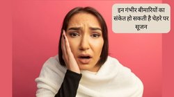 Morning Face Swelling: सुबह सोकर उठने पर आपको भी दिखती है चेहरे पर सूजन? इन गंभीर बीमारियों का संकेत हो सकता है ये, जानें कब कराएं जांच