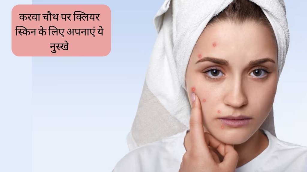 Karva Chauth । Pimple Home Remedies । Acne Marks Home Remedies