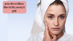 चेहरे पर जगह-जगह हो गए हैं मुंहासे तो आज से ही अपना लें ये टिप्स, करवा चौथ से पहले एकदम क्लियर हो जाएगी स्किन