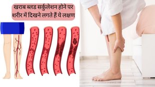 Blood Circulation । symptoms of poor blood circulation । symptoms of poor blood circulation in body