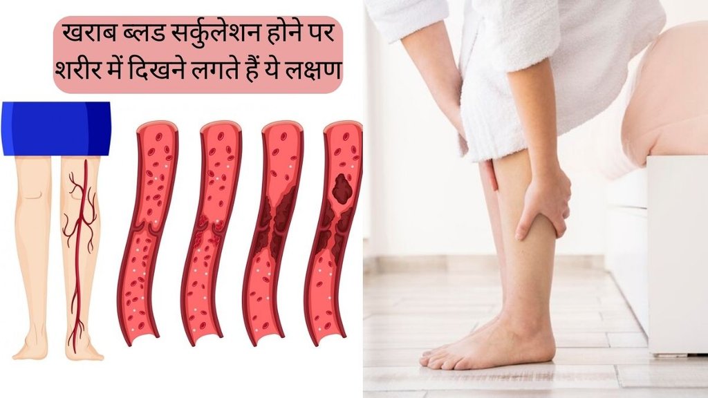 Blood Circulation । symptoms of poor blood circulation । symptoms of poor blood circulation in body Blood Circulation । symptoms of poor blood circulation । symptoms of poor blood circulation in body
