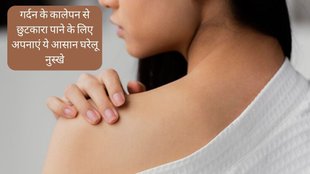 Dark Neck Remedy । Beauty Tips । get rid of dark neck overnight