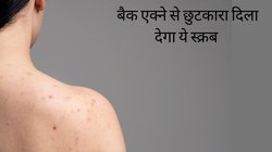 बैक एक्ने से भद्दी दिखती है कमर? रसोई में मौजूद इन चीजों से बना लें एंटीबैक्टीरियल स्क्रब, गायब हो जाएंगे एक-एक दाने, खुलकर पहन सकेंगी बैकलेस ड्रेस
