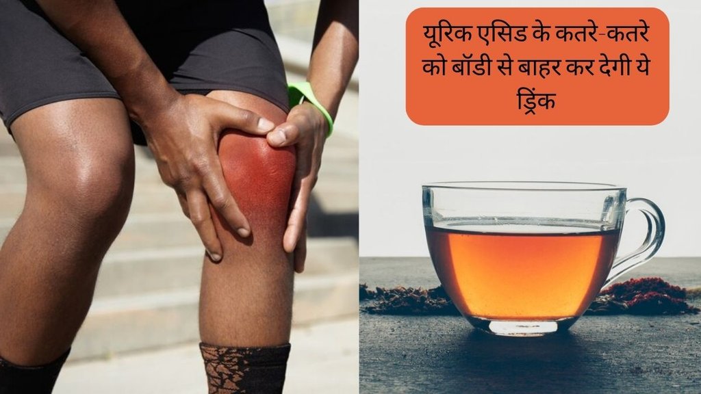 Uric Acid । Ajwain for Uric Acid । Uric Acid Treatment