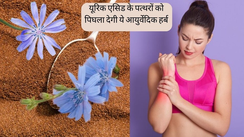 Uric Acid । Uric Acid Treatment । Chicory for Uric Acid