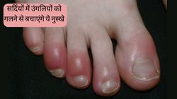 हल्की ठंड आते ही सूजकर नीली पड़ने लगती हैं हाथ-पैर की उंगलियां? राहत पाने के लिए अपना लें ये घरेलु नुस्खे, गलने से बचे जाएंगी Fingers