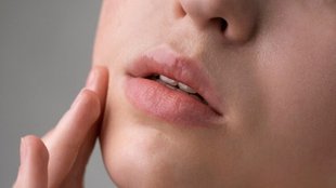 honey for lips, how to apply honey on lips, coconut oil on lips, ghee on lips, malai on lips, होठों को मुलायम कैसे रखें, होठों पर पपड़ी आना