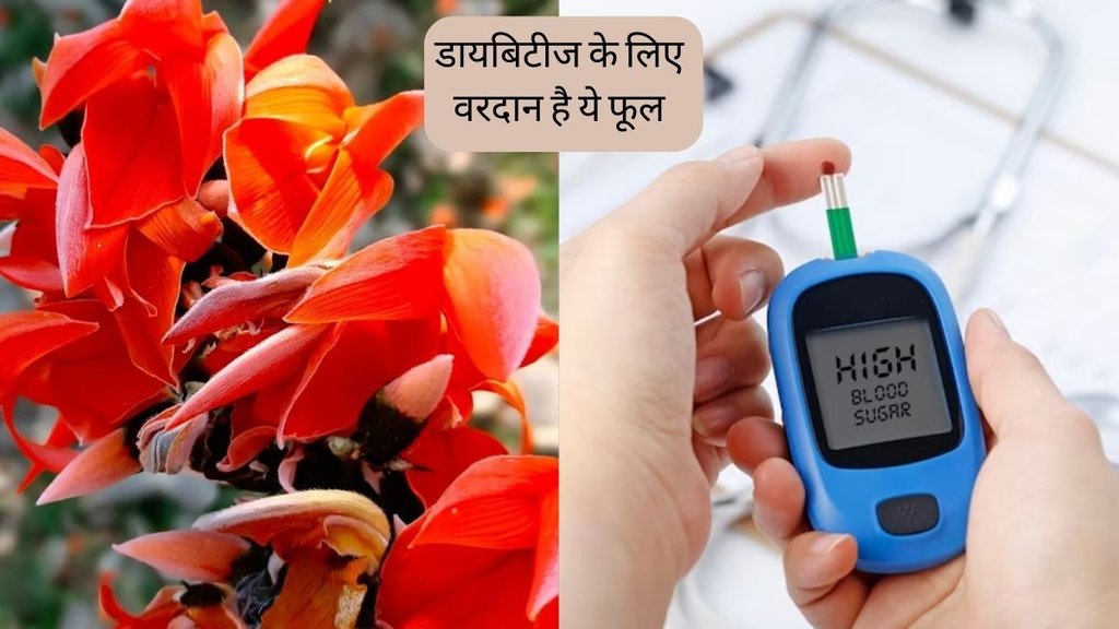 Diabetes । Diabetes Diet । Palash Flower for diabetes