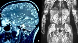खाता था कुछ ऐसे कि दिमाग में कीड़ों ने बसा लिया ‘गांव’, हैरान कर देने वाला है मामला