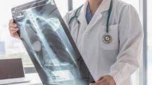 Tuberculosis| children