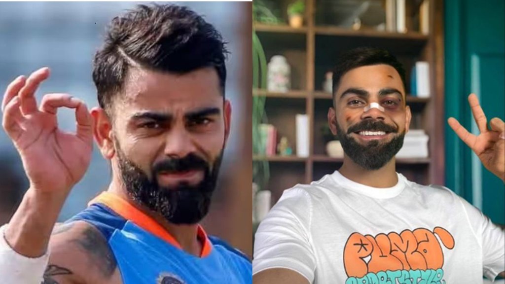 virat kohli | virat kohli instagram | virat kohli story