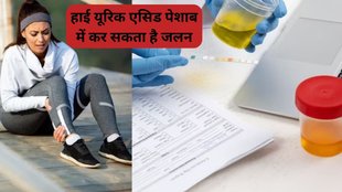 frequent urge to urinate, fever and joint pain, feeling like nausea, weakness and chills, यूरिक एसिड बढ़ने के लक्षण