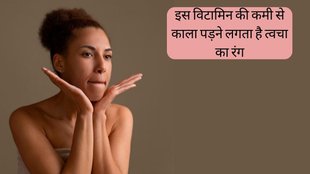 Skin Color । Dark Skin Remedy । Winter Skin Care । Winter Skin care tips