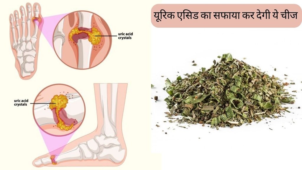 Uric Acid । Dried Mint benefits । Dried Mint For uric acid Uric Acid । Dried Mint benefits । Dried Mint For uric acid
