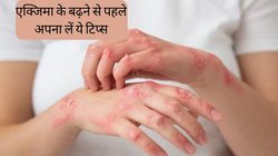 स्किन पर लाल चकत्ते, पानी भरे दाने और खुजली हो सकते हैं एक्जिमा के लक्षण, चर्म रोग से बचने के लिए अपनाएं ये टिप्स