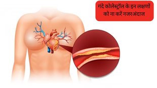 High Cholesterol Symptoms । High Cholesterol । bad cholesterol signs