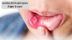 शरीर में दिख रहे ये बदलाव हो सकते हैं HIV के लक्षण, जानलेवा होने से पहले कर लें पहचान