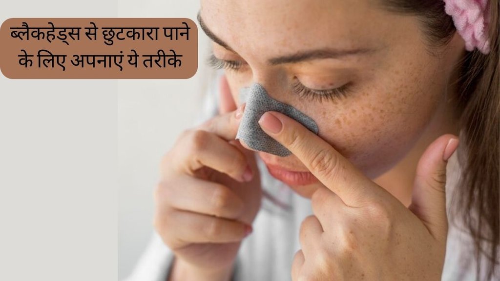 Skin Care Tips । Blackheads । Remedies For Blackheads