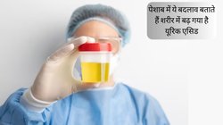 पेशाब में दिखें ये 3 बदलाव तो समझ जाएं शरीर में बहुत अधिक बढ़ गया है यूरिक एसिड, किडनी के ठप पड़ने से पहले करा लें जांच