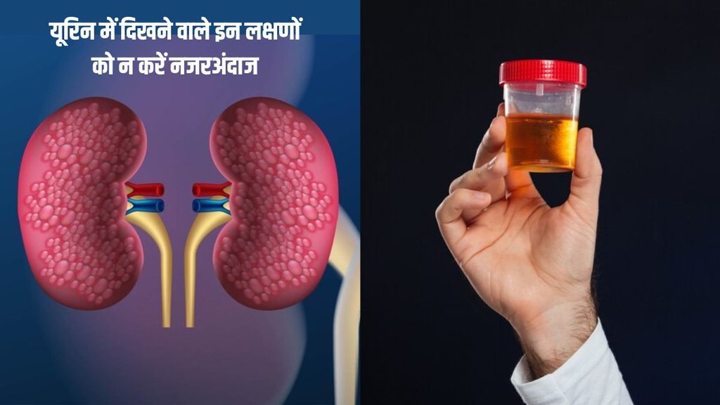 Kidney Damage Signs । Kidney Symptoms । Damage kidney Sigh