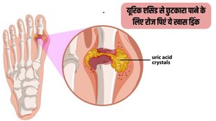 Uric Acid । Uric Acid Treatment । Uric Acid Home Remedies