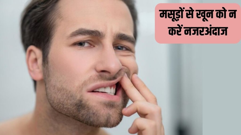 Gum Bleeding । Vitamin C deficiency । Health News