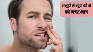 Gum Bleeding । Vitamin C deficiency । Health News