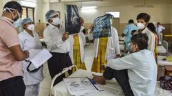 ‘ब्लैक फंगस’ के मरीजों को 3डी तकनीक से मिलेगा नया चेहरा, IIT मद्रास के छात्रों ने किया कमाल
