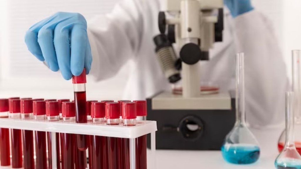 Thyroid Test,What blood test should be done after the age of 40? What are the different types of blood tests, जरूरी ब्लड टेस्ट, थायरॉइड टेस्ट