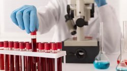 इन 5 Blood Test से जानें अपनी सेहत का राज़, आने वाली बीमारियां ही नहीं शरीर की ताकत का भी चलेगा पता, साल में एक बार जरूर कराएं