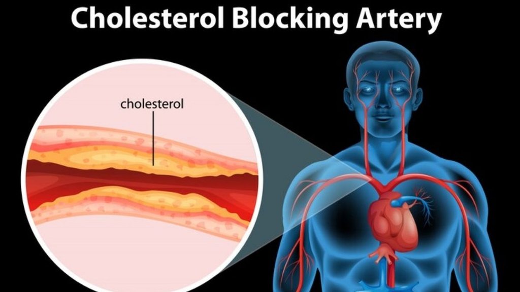 LDL cholesterol levels, medibuddy study, good cholesterol, blood pressure,कोलेस्ट्रॉल कंट्रोल करने वाले फूड्स,गुड कोलेस्ट्रॉल कैसे बढ़ाएं
