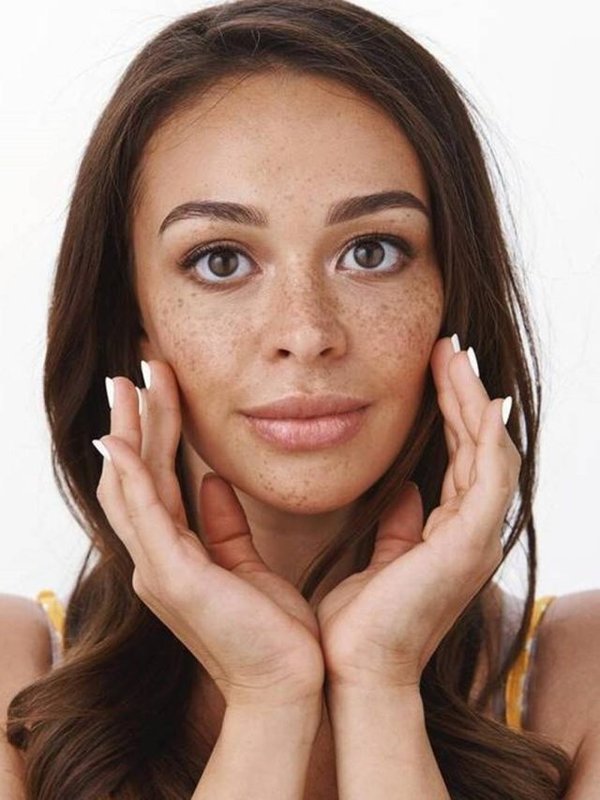 FRECKLES CHHAI ON SKIN