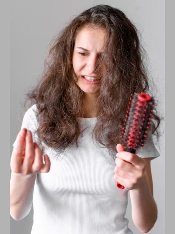 Hair Fall । Hair Fall Remedies । Hair Care