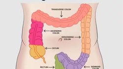 मल के साथ खून, पेट में दर्द आंतों में सूजन के हो सकते हैं संकेत, इन 4 फूड्स से करें परहेज़, ज़हर की तरह करेंगे वरना असर