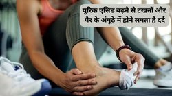 क्या बॉडी 70% से ज्यादा यूरिक एसिड बना रही है? इसके बाद पैर के अंगूठे में सूजन, दर्द और गर्म होने के आ रहे हैं लक्षण, जानिए कैसे करें Uric Acid को तुरंत नॉर्मल