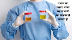 यूरिन का रंग बताता है शरीर में हो गई है पानी की कमी, सर्दी में डिहाइड्रेशन कैसे यूरिन के लिए खतरनाक है, जानिए Urine की किन 3 बीमारियां का बढ़ता है खतरा