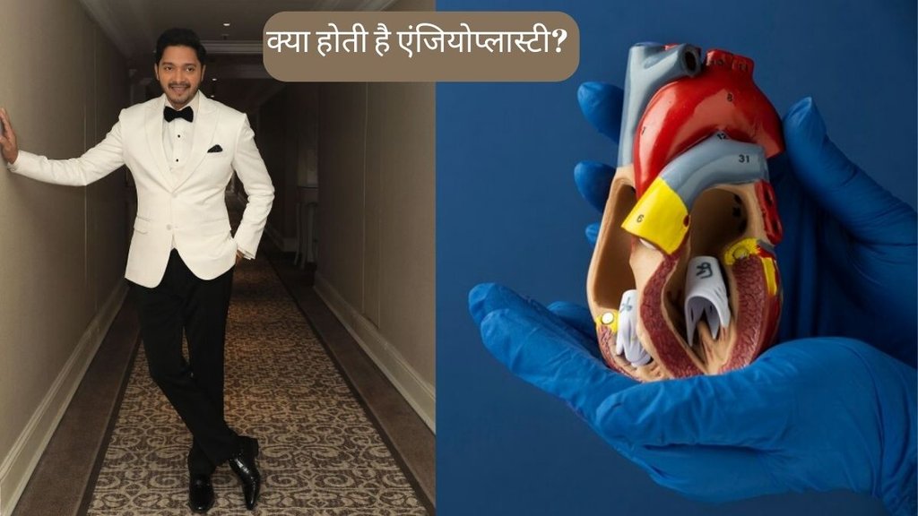 Angioplasty । Angioplasty Treatment । what is Angioplasty