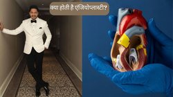 Angioplasty के बाद हुआ श्रेयस तलपड़े की हालत में सुधार, जानें क्या है ये इलाज और कब पड़ती है इसकी जरूरत