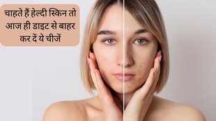 Skin Care । Beauty Tips । Skin Care Tips