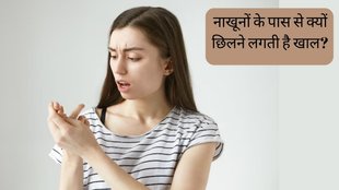 Peeling Cuticles । Nail Care । Health News
