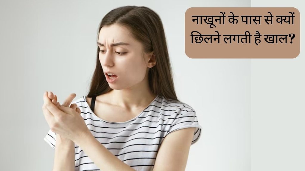 Peeling Cuticles । Nail Care । Health News