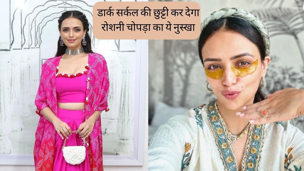 Dark Circles । Dark Circles Home Remedies । Beauty Tips