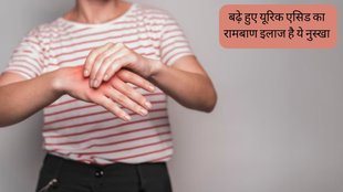 Apple Cider Vinegar for Uric acid । Hyperuricemia । Uric acid