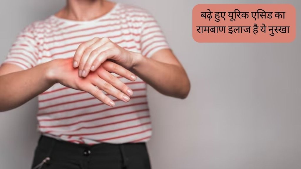 Apple Cider Vinegar for Uric acid । Hyperuricemia । Uric acid